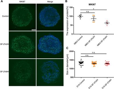 Sevoflurane promotes premature differentiation of dopaminergic neurons in hiPSC-derived midbrain organoids